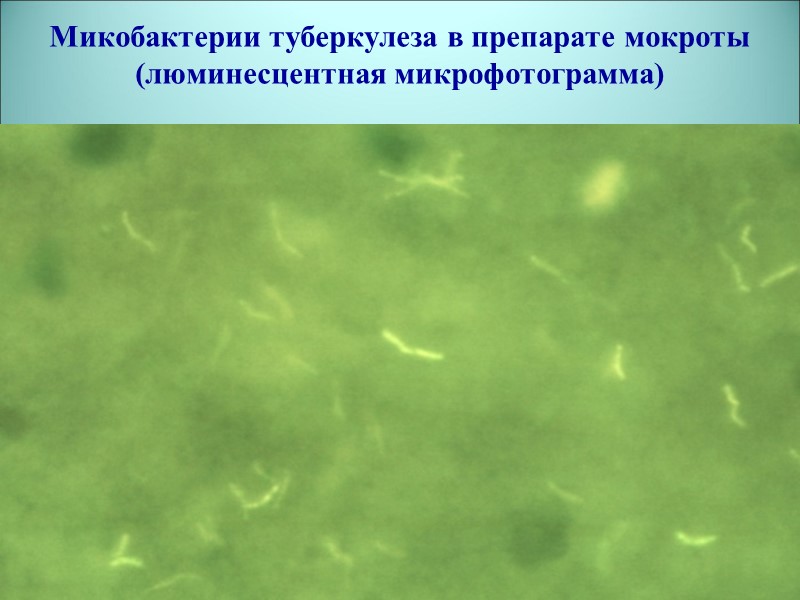 Микобактерии туберкулеза в препарате мокроты (люминесцентная микрофотограмма)